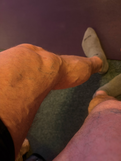 bare legs showing veins and musculature with slightly bent knees standing on a yoga mat